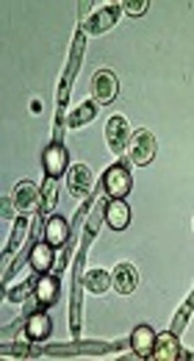 Frequency of <i>Candida</i> Species Isolated from Patients in Children’s Medical Center, Tehran, Iran